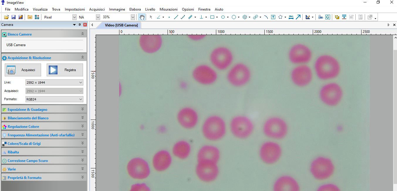   Camera per microscopi usb da 5mpx con numerosi accessori  